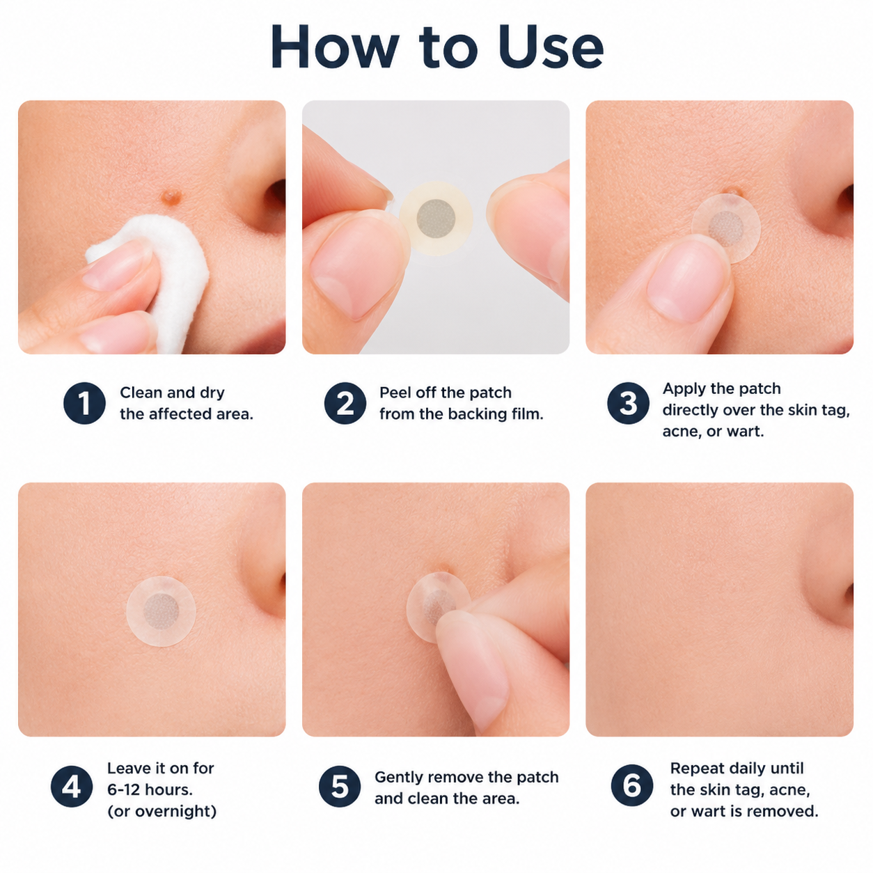 ✨LUMIVO™2-in-1 Microneedle & Hydrocolloid Patch🍀| Removes Raised Moles, Acne, Flat Warts & Skin Tags | Helps Improve Wrinkles, Scars & Blemishes | Invisible Patches for Face & Body