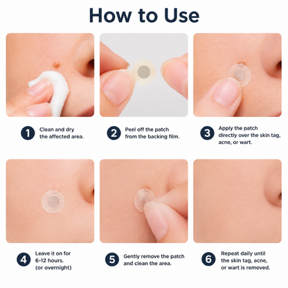 ✨LUMIVO™2-in-1 Microneedle & Hydrocolloid Patch🍀| Removes Raised Moles, Acne, Flat Warts & Skin Tags | Helps Improve Wrinkles, Scars & Blemishes | Invisible Patches for Face & Body