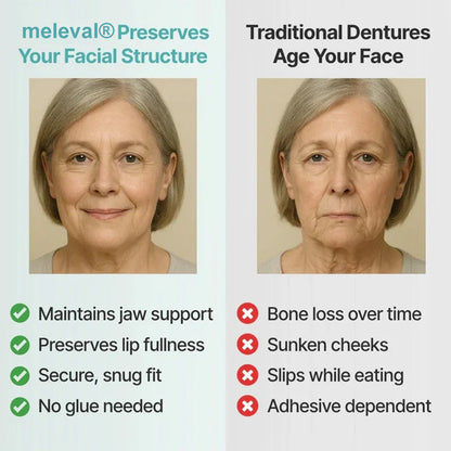 🎁🌎Ends Today: 70% OFF! ⏰meleval® Medical Full Denture with Strong Suctiond🦷Obtain American Dental Association (ADA) Certification