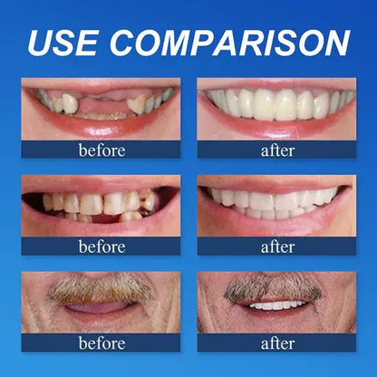 🎁🌎Ends Today: 70% OFF! ⏰meleval® Medical Full Denture with Strong Suctiond🦷Obtain American Dental Association (ADA) Certification