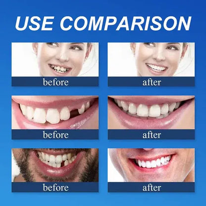 🎁🌎Ends Today: 70% OFF! ⏰meleval® Medical Full Denture with Strong Suctiond🦷Obtain American Dental Association (ADA) Certification